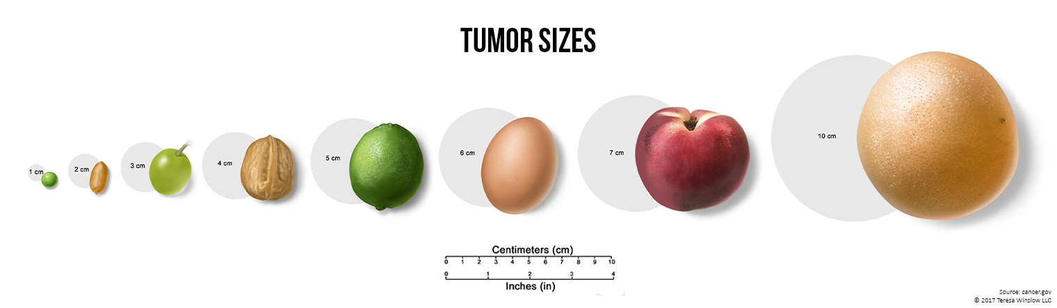 Tumour sizes
