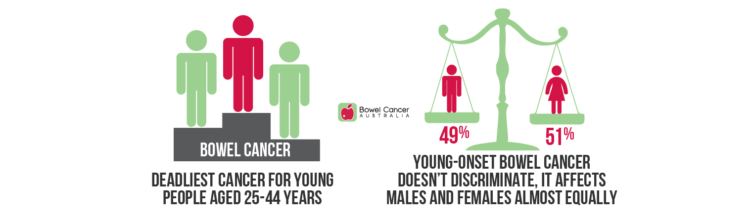 Young-onset bowel cancer facts