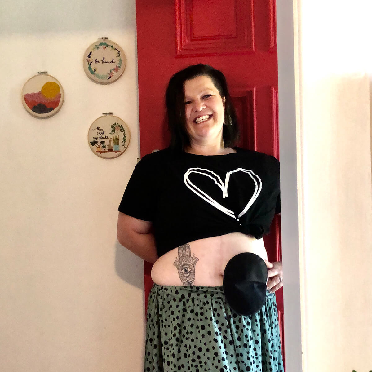 A woman smiles while holding her shirt up, revealing a tattoo on her abdomen and a round black object on her side.