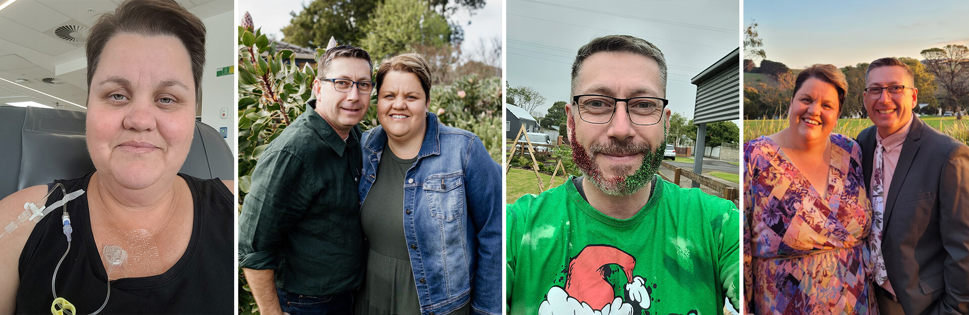 A collage of four images showing a woman undergoing treatment, a couple in a garden, a man with a colorful beard, and a couple dressed up for an event.
