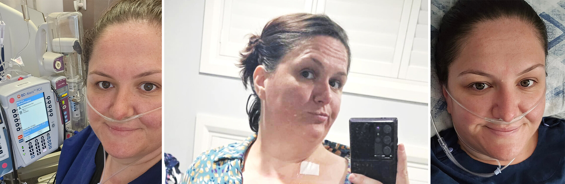 Three selfies of a woman with an oxygen tube, in a hospital setting, and at home, showing various expressions.