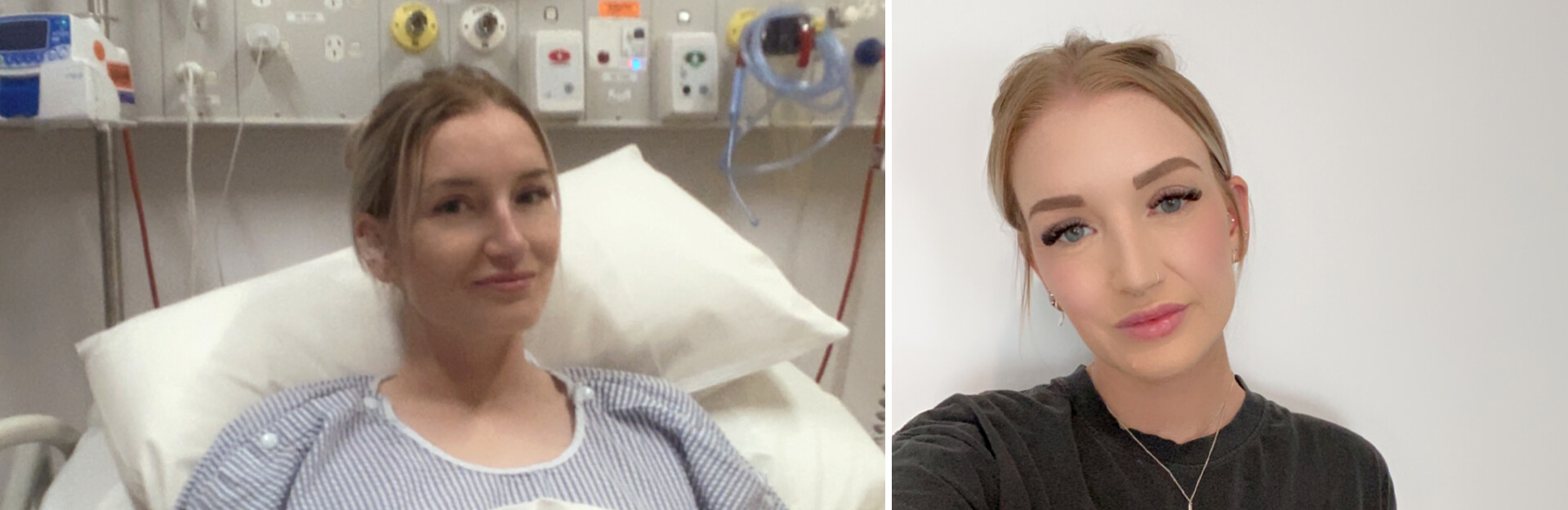 A woman in a hospital bed on the left and a close-up selfie of her smiling on the right.