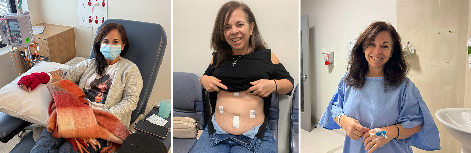 A woman in three settings: receiving treatment in a hospital, showing her stomach with bandages, and smiling in a patient gown.