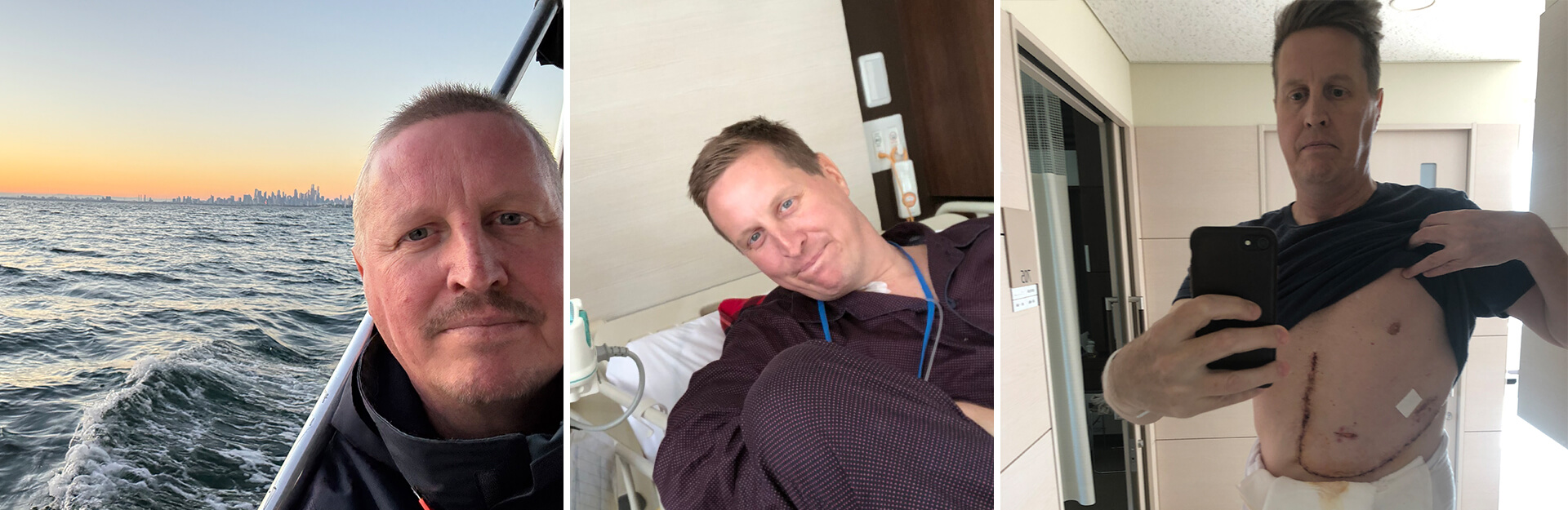 A collage of three images: a sunset over water, a man in a hospital bed, and a man showing a surgical scar.
