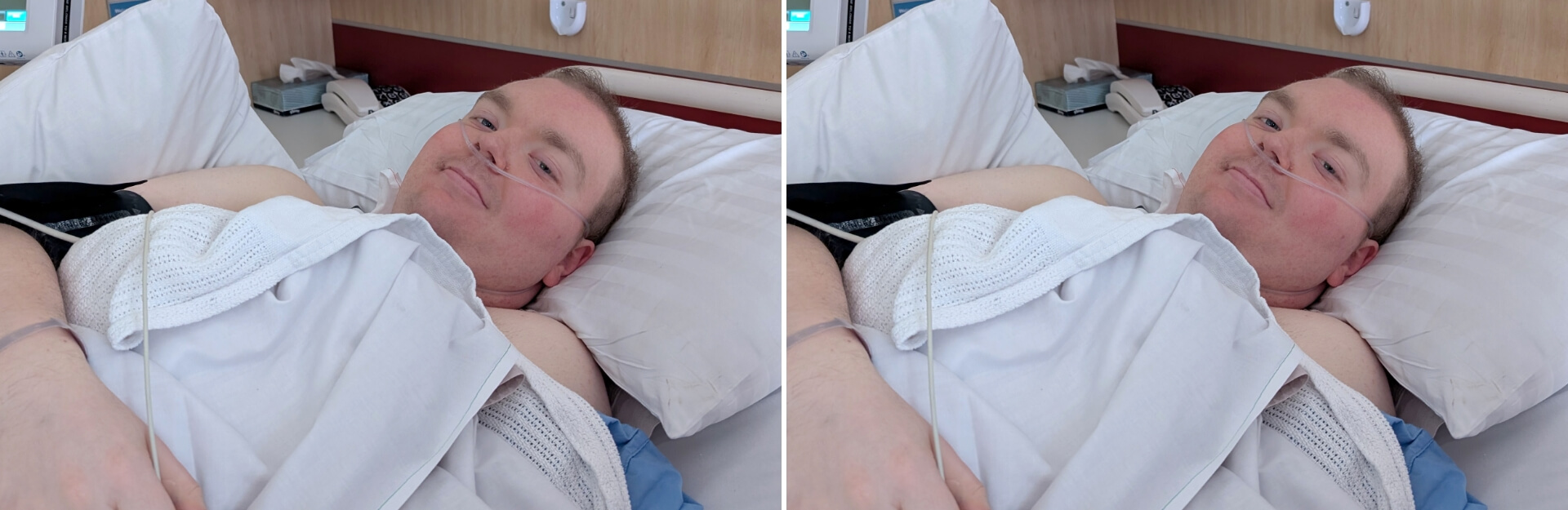 A patient lying in bed with a nasal cannula, looking at the camera, surrounded by hospital bedding and equipment.