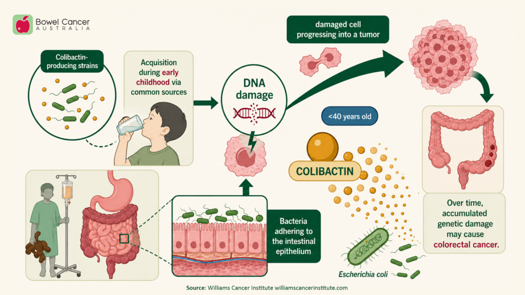Infographic explaining colibactin, DNA damage, and its link to colorectal cancer in children under 40 years.