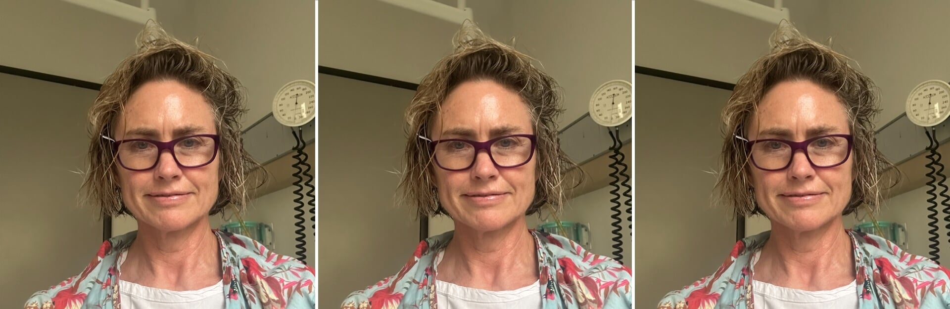 A woman with short, curly hair and purple glasses is smiling, wearing a floral-patterned shirt, in a medical setting.