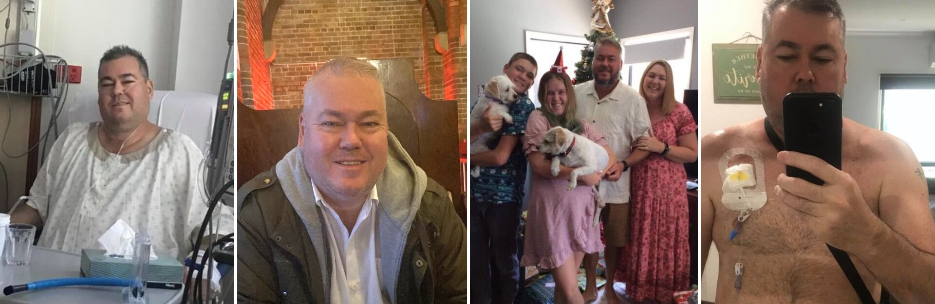 A series of four photos: a man in a hospital gown, smiling in casual attire, with family and pets, and a shirtless selfie with medical equipment.